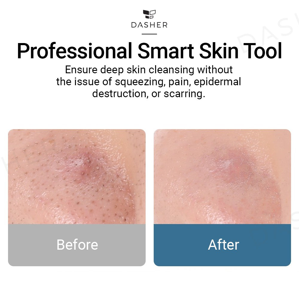 Meishi Smart Visual Pore Cleaner