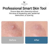 Meishi Smart Visual Pore Cleaner
