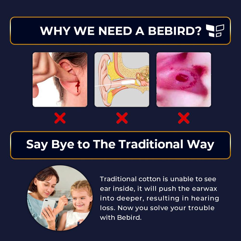 Bebird Note 3 Pro Smart Visual Ear Tweezer